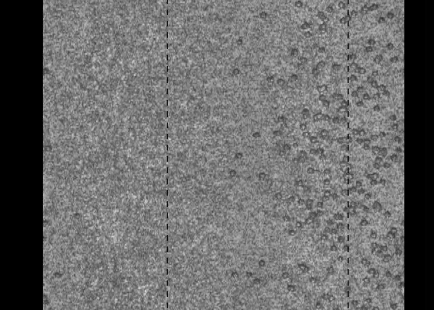 Detecting and Understanding Deep Pitting